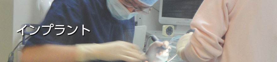 インプラント